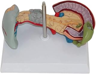 Assembly Model Pancreas Spleen and Duodenum Pathology Model, Scientific Anatomical Human Body Model, Liver Gastrointestinal Model, Gastroenterology, Disease Model