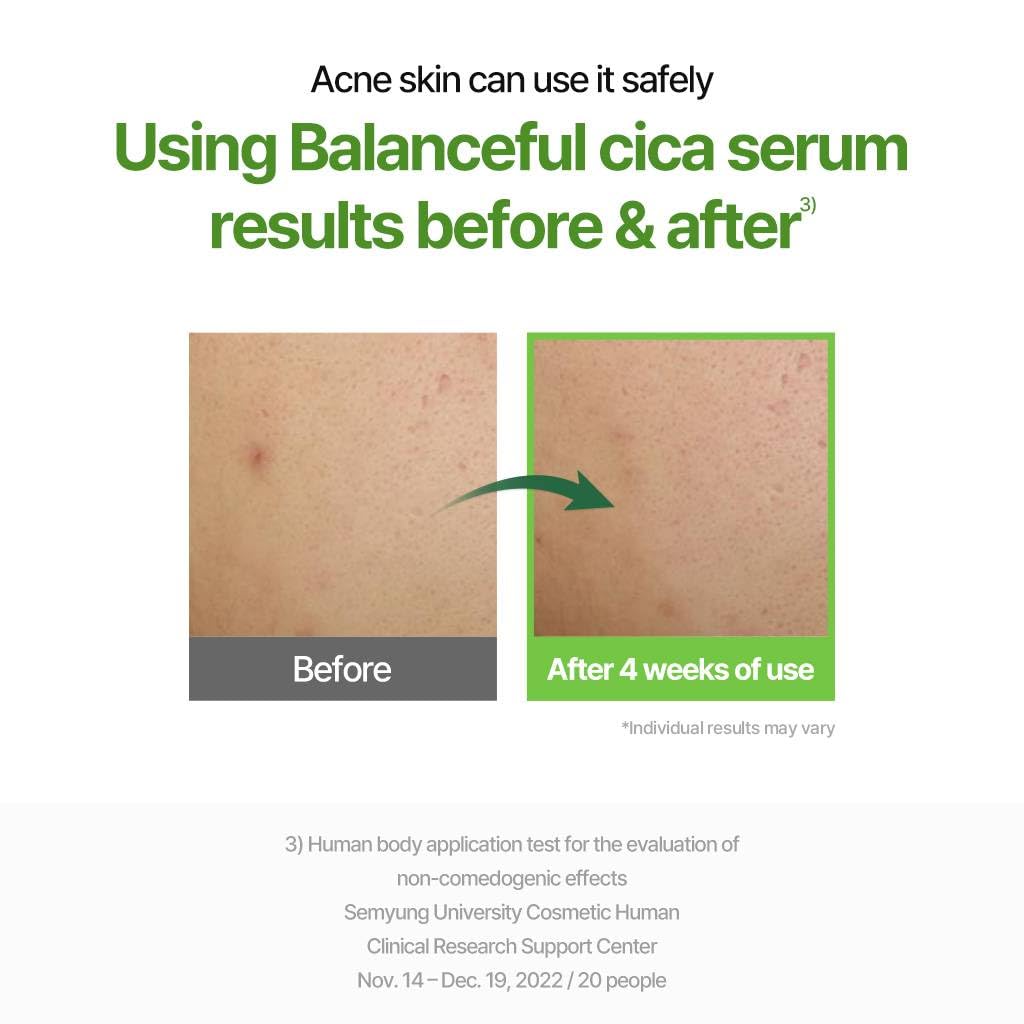 Torriden Balanceful Serum, 49.96 ml (Pack of 1) - Image 3