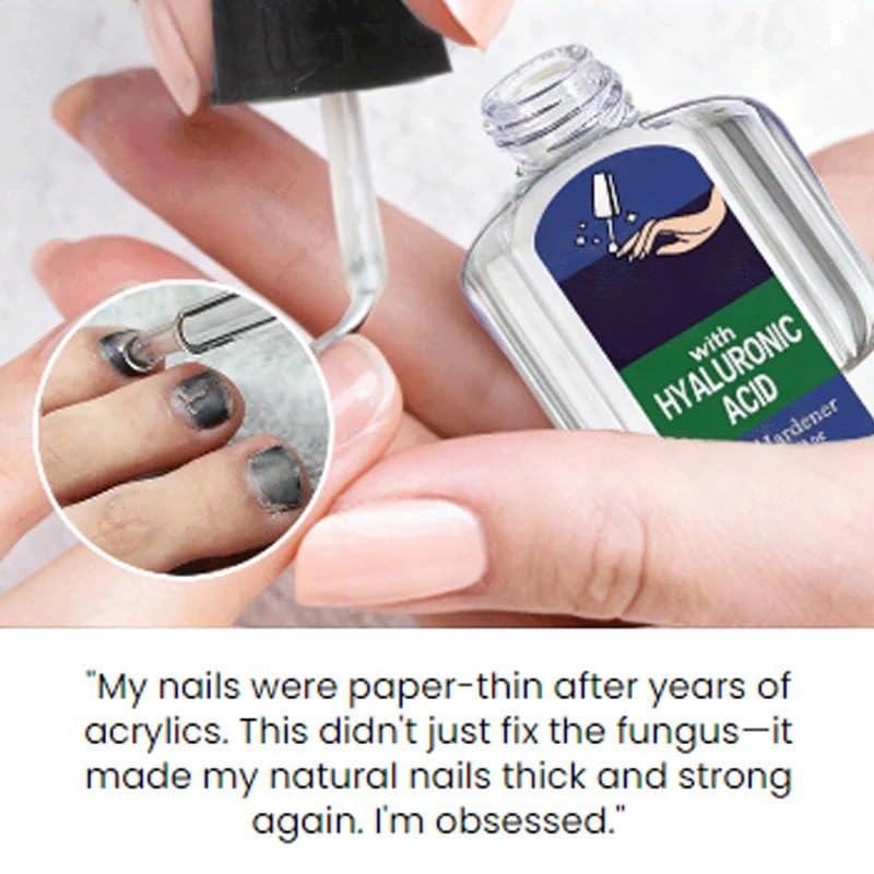 Miniatura 4 de Solución natural de reparación de uñas suave y eficaz, reparación de uñas multiusos, solución de uñas para uñas descoloridas y dañadas, mejora