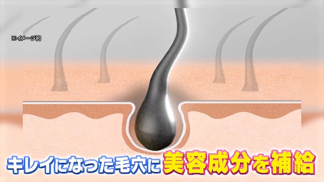 Amazon | UNELESS ウネレス 特別セット 炭酸シャンプー トリートメント