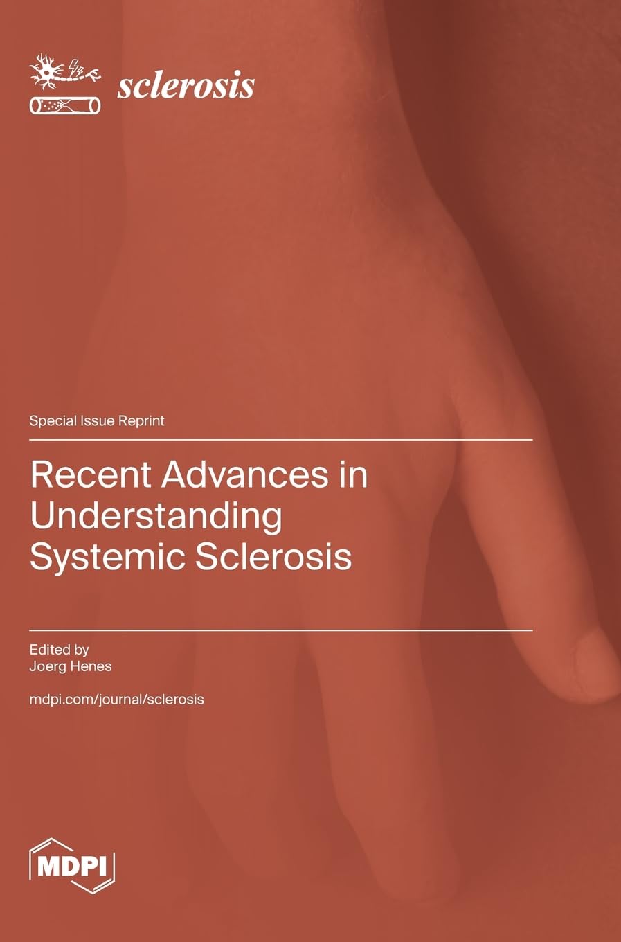 Recent Advances in Understanding Systemic Sclerosis