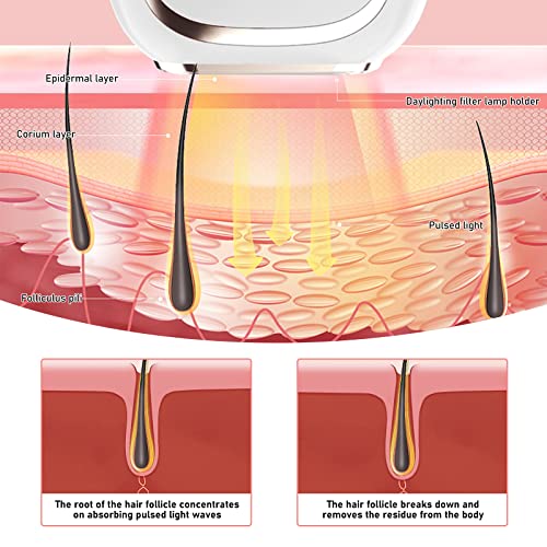 IPL-Haarentfernungsgerät, mit ICE-Kühlsystem, 990000 Impulse, schmerzloses Hautverjüngungs-Haarentfernungsgerät (Weiß) - Image 4