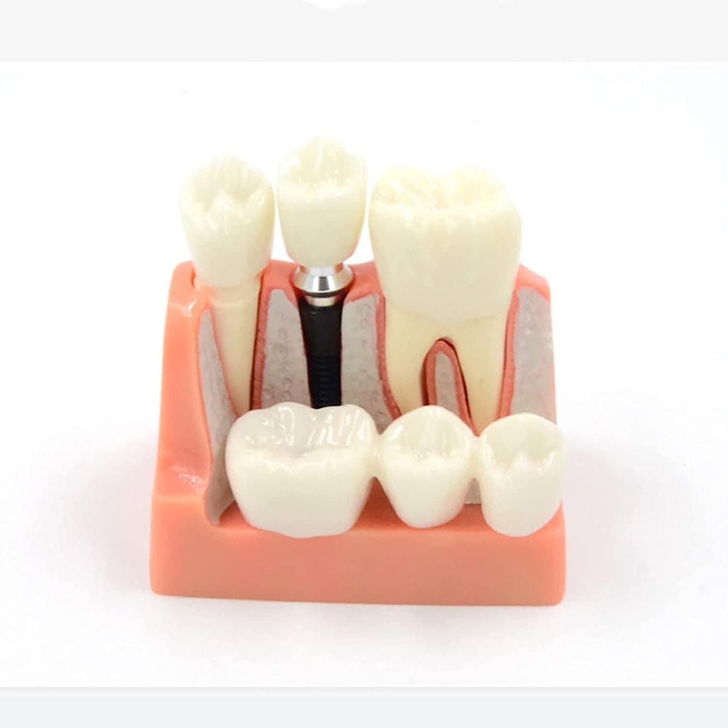 1000 Ul Di Punta Per Pipette Box 100 Posizioni, Scatola Vuota Per Punte Di Pipette Da 1000 L 1 Ml Di Scatola Per Pipette Da Laboratorio - Foto 6