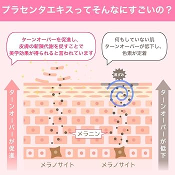 Amazon.co.jp: デリケートゾーン vio 黒ずみ フェムケア