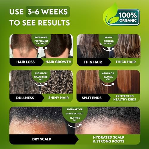 Batana Oil Shampoo for Hair Growth - Routine Shampoo for Thinning Hair for Women & Men - 9-in-1 Natural Hair Loss Shampoo with Biotin, Rosemary Oil - Thickening Hair Treatment & Regrowth - Image 4