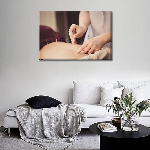 Image of TUMOVO Physical Therapists do Acupuncture Canvas Wall Art Traditional Chinese Medicine Canvas Photo 1 Panels Prints for Wall Decor Giclee Print Gallery Packaging Artwork Ready to Hang (16 inch Wx24 H)