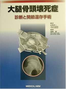 大腿骨頭壊死症 診断と関節温存手術  /メジカルビュ-社/渥美敬（単行本） 5132BZ551CL._UF350,350_QL50_.jpg