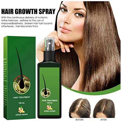 Hair Growth Serum, Ginger Germ Oil, Hair Loss And Hair Thinning Treatment, Hair Serum, Promote Thicker Hair Growth, Anti Hair Loss (1 Oz) #TOP1