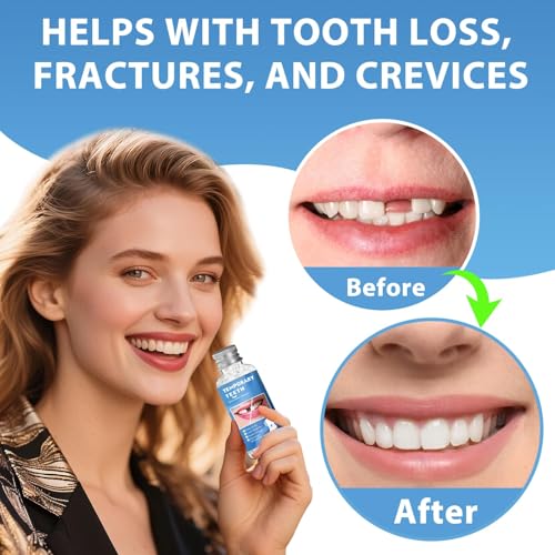 Image of Tooth Repair Kit, Moldable False Teeth Beads for Teeth Repair, Suitable for Missing, Cracked DIY Denture Kit, 4PCS