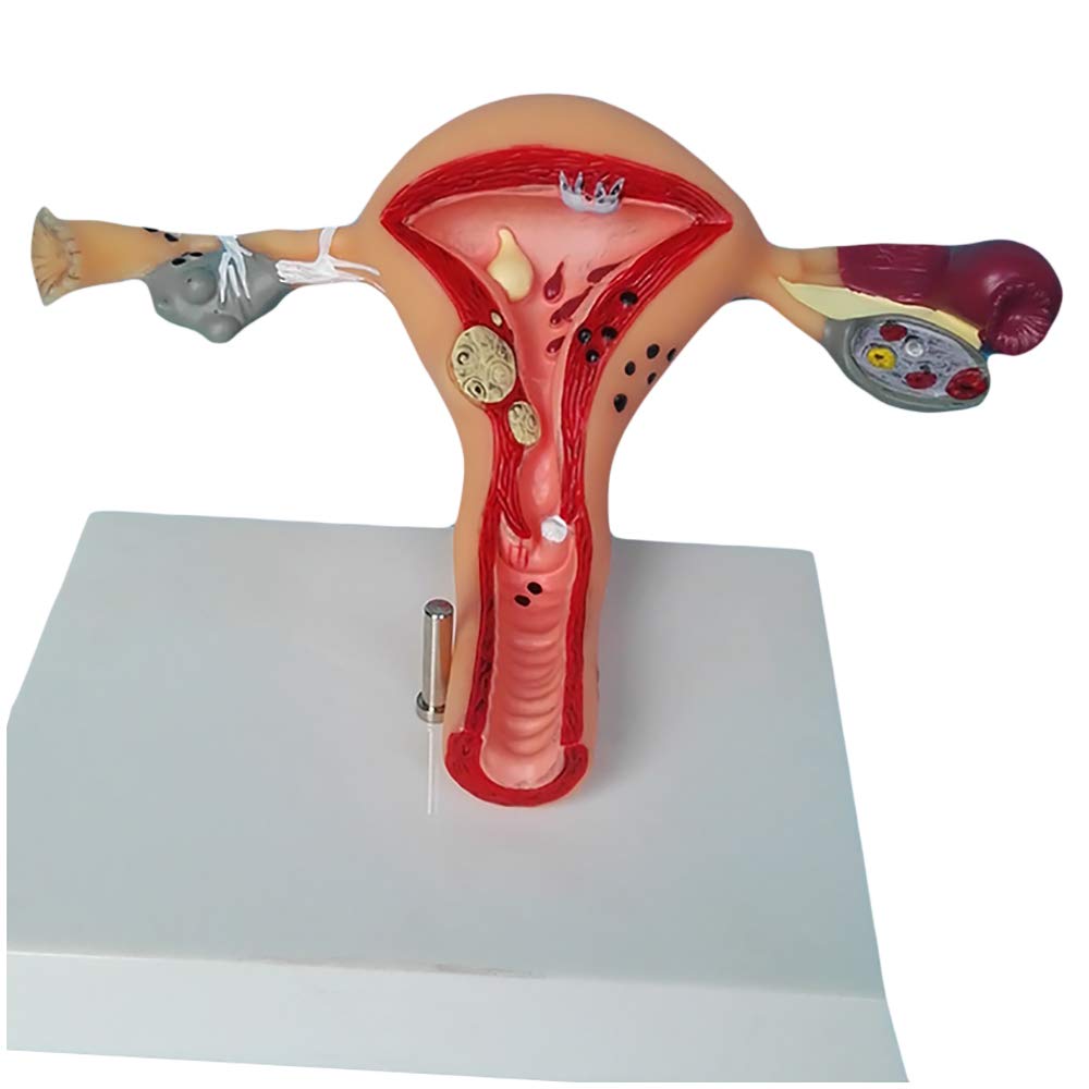 sjdoPulse Uterus Ovary Anatomical Model with Pathologies - Human Organ Anatomical Model Human Uterus Model - Medical Anatomical Uterus Model - for Medical Educational Training Aid