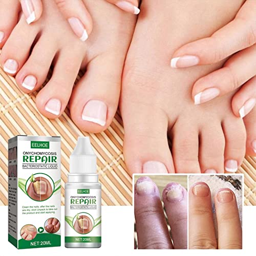 Reparação de unhas | Fortalecedor de unhas para unhas finas | Fortalecedor de unhas para unhas danif