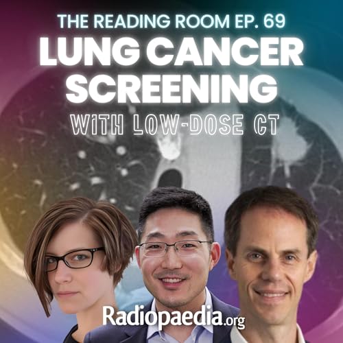 69. Lung cancer screening with low dose CT Podcast Por arte de portada