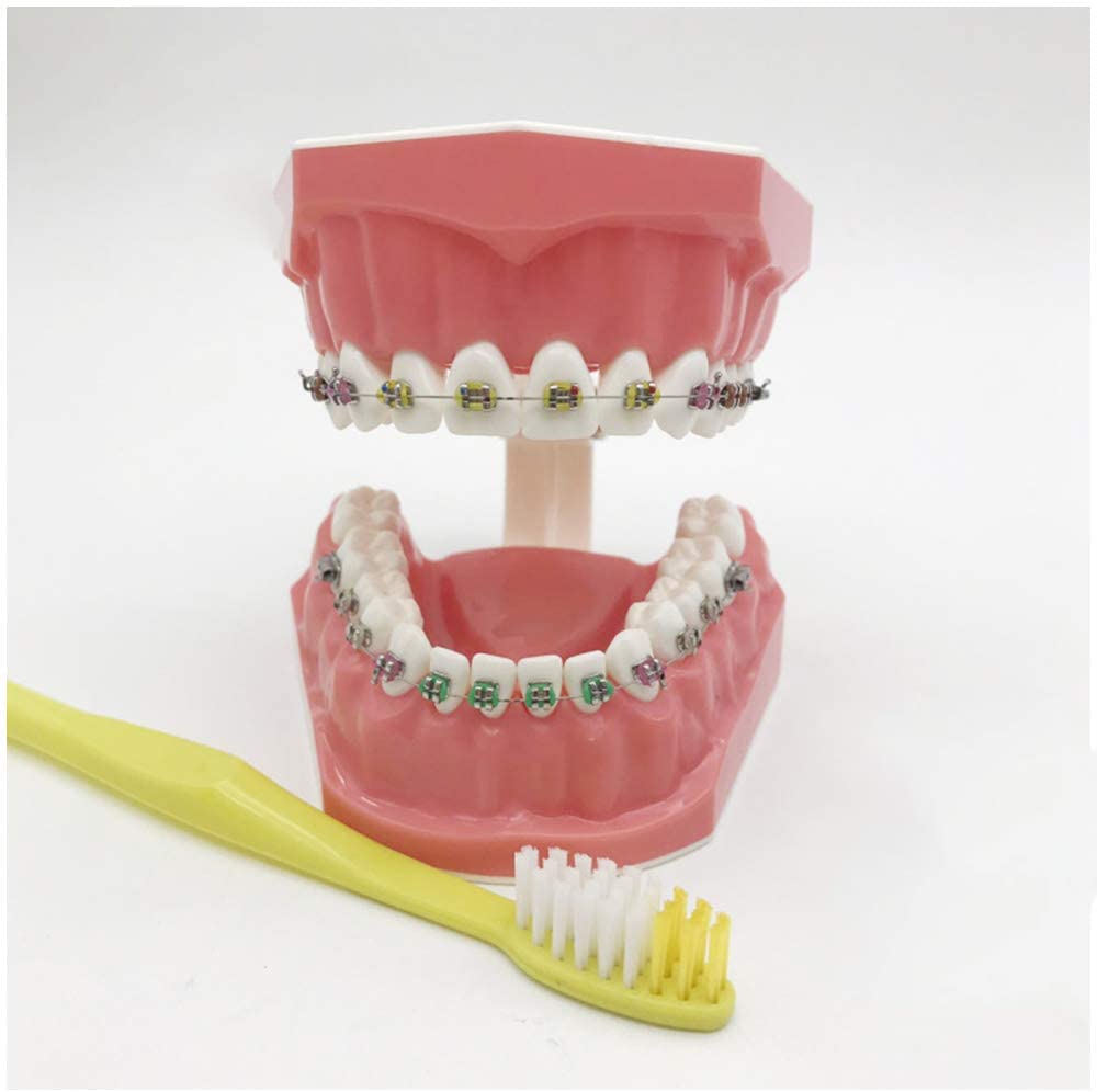 Modello Di Denti Per La Formazione - Modello Ortodontico - Modello Di Insegnamento Dei Denti Con Staffa In Metallo E Ceramica - Modello Di Formazione Correttiva Dei Denti Per L'insegnamento Dell'igien