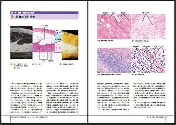 臨床と病理のための乳腺疾患アトラス 前田 一郎; 土屋 眞一 臨床と病理のための乳腺疾患アトラス | 前田 一郎, 土屋 眞一