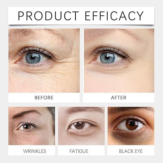 Image of GLOWISH VC Under-Eye Serum Roll-On Vitamin C + Plant Extracts | Cooling Stainless-Steel Roller for Dark Circles, Puffiness & Fine Lines | Fast-Absorbing, Non-Sticky Eye Gel (15Ml)
