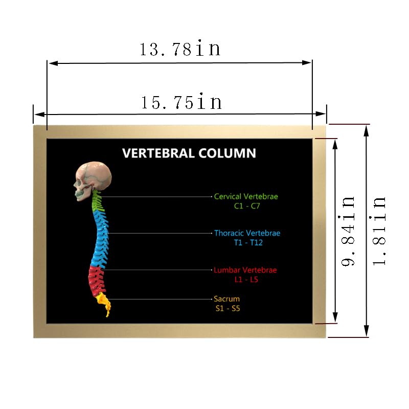 Image of Taanfu Body Educational Learning Anatomy Posters ，Vertebrae Column Art Vertebrae Column Villi Anatomy Art Poster Digestive System Organs Illustration Small Intestine Physiology Anatomy Wall Art Villi