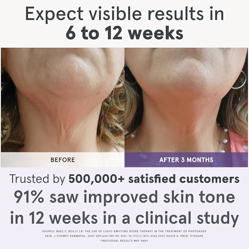 iRestore Illumina Advanced LED Skincare Bundle: Face, Neck & Chest Anti-Aging Mask - Image 4