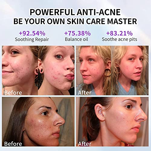 Aravli Omega PDT LED Light Therapy Facial Machine, Face Whitening, Rejuvenation Skin Care Beauty Equipment Led Facial Machine Light Therapy Beauty Device - Image 4