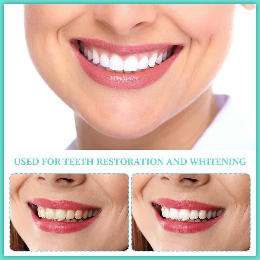 2 Paia Faccette Istantanee, Protesi a Sorriso Perfetti, Denti Finti Cosmetici, impiallacciature denti copertura dentale cosmetica, Denti Finti Cosmetici per Donne e Uomini