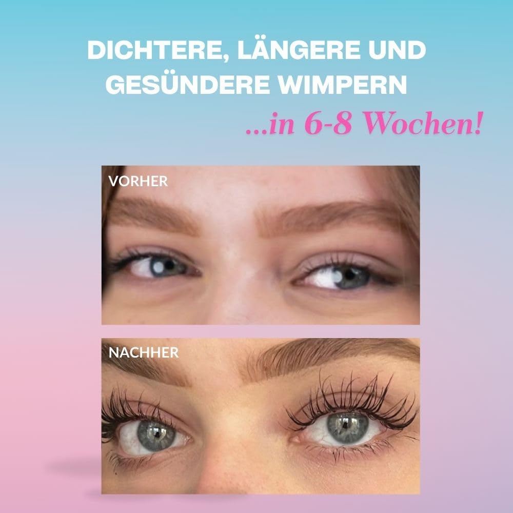 Annixashley Lash Wimpernserum für Premium Wimpernserum für Längere & Dichtere Wimpern – Wachstumsfördernde Formel mit Biotin und Peptiden – Sichtbare Ergebnisse in 6-8 Wochen