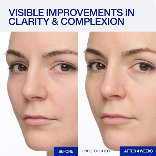 Image of IOPE Expert Vitamin C 25% Antioxidant Serum - 25% Pure Vitamin C Face Serum - Visibly Evens Skin Tone, Enhances Radiance, and Smooths Texture - 5 Antioxidants and PHA - 0.77 fl. oz.