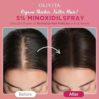 5% Minoxidil Spray for Women Hair Growth: Extra Strength Hair Regrowth Treatment – Revitalize Hair Follicles & Regrow Thicker, Fuller Hair – Hair Loss Solution - 2 Packs