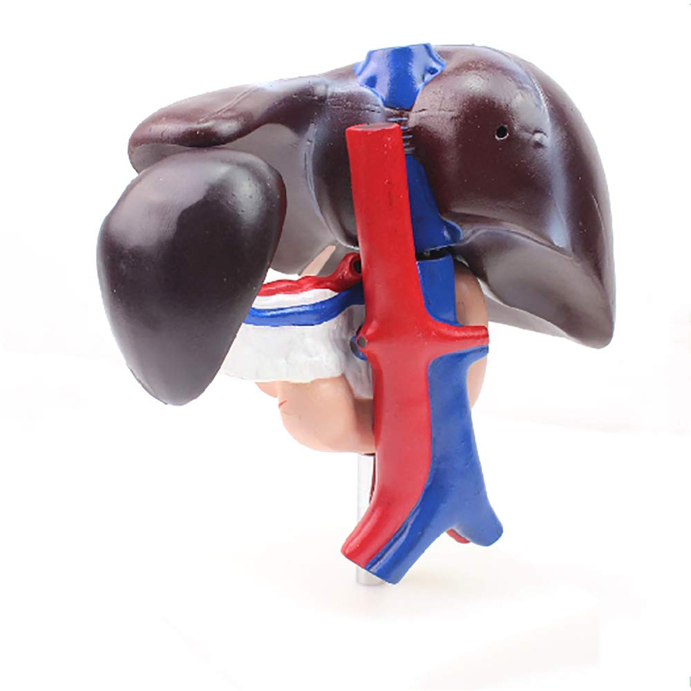 CNRGHS Pathological Model Of Pancreas, Medical Pathological Model Of Pancreas, Hepatobiliary Digestive System Gastroenterology, Anorectal Doctor-patient Communication Model