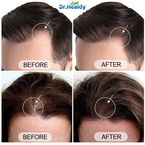 Image of Dr.Healdy Batana Oil Shampoo for Hair Growth, Against Hair Loss & Moisturizes, Reduces Breakage - Sulfate Free Formula for All Hair Types (6.8 Fl Oz)