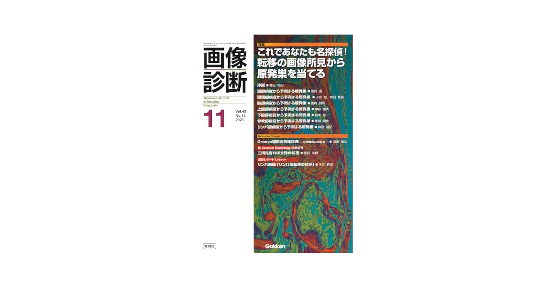 画像診断2023年11月号 Vol.43 No.13: これであなたも名探偵