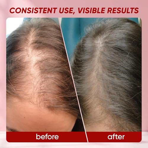Shwfhi Hair Growth Vitamins Gummies