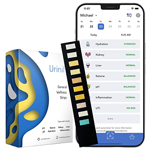 Top 10 Best Urine Iodine Test Kit Reviews & Buying Guide Katynel