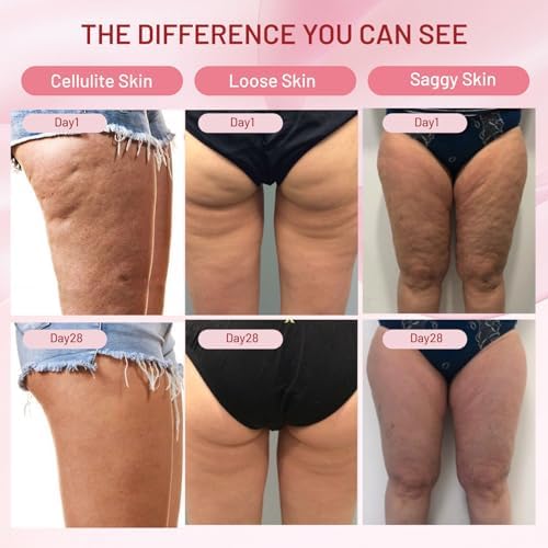 Inner Thigh Firming Cream, Remove Cellulite, Tighten Saggy Skin, 4.22 Fl Oz — 사진 3