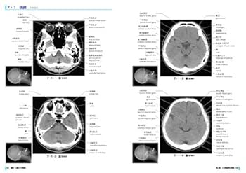 最新・X線CTの実践 ［診療画像検査法] | 勇雄, 金森, 靖司, 井戸