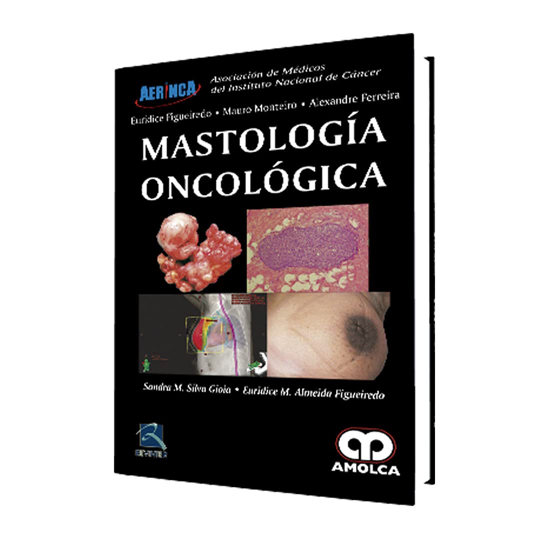 MASTOLOGIA ONCOLOGICA