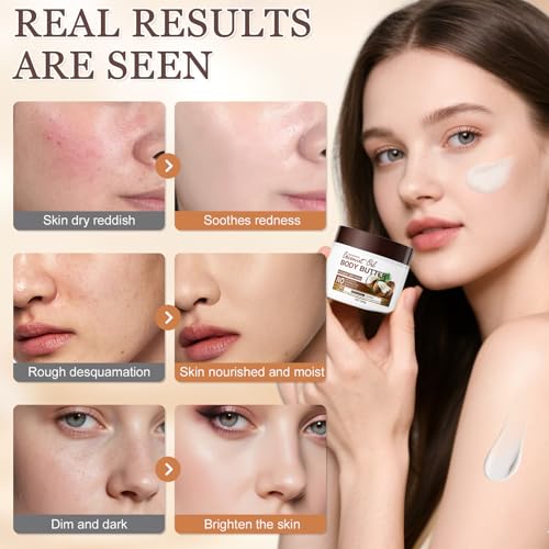 Crema Hidratante Corporal con Coconut Oil, Crema Corporal Natural Aceite de Coco Piel Seca, Manteca Corporal Coco, Hidratante y No Grasa, Body Lotion para Hombres y Mujeres, Fórmula Vegana - 200g - imagen 5