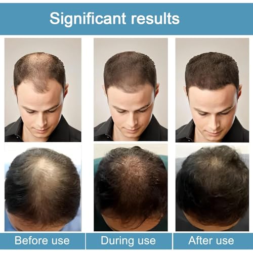 Thicair Hair Regrowth System - Advanced Hair Growth Treatment with Copper Peptides & Collagen, Knotweed and Ginseng Root Extract, Hydrating & Fuller Hair Kit for Fine or Thinning-Looking Hair (1) - Image 7