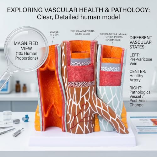 Modelo de vasos sanguíneos con progresión de trombo en 4 etapas para estudio anatómico 3