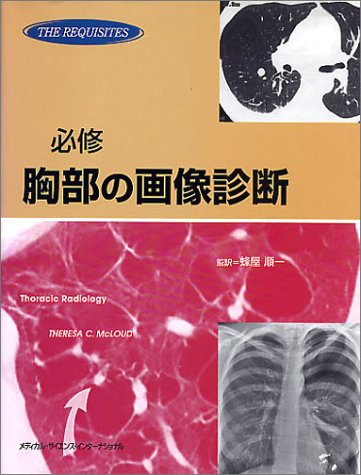 スマホ 無料電子書籍 必修 胸部の画像診断 バイ