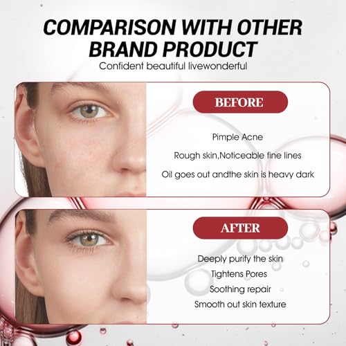 Fruchtsäurepeeling Gesicht, AH-A 30% + BHA 2% Chemisches Peeling Gesicht, Fruchtsäurepeeling Frauen, Sanftes Peelings, Feuchtigkeitsspendend, Geeignet für Eine Vielzahl von Hauttypen