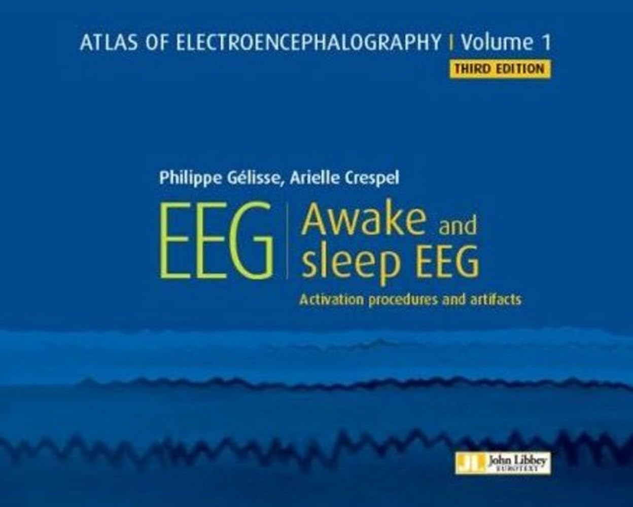 Atlas of Electroencephalography -- Volume 1 by Philippe Gelis... - 9782742015900