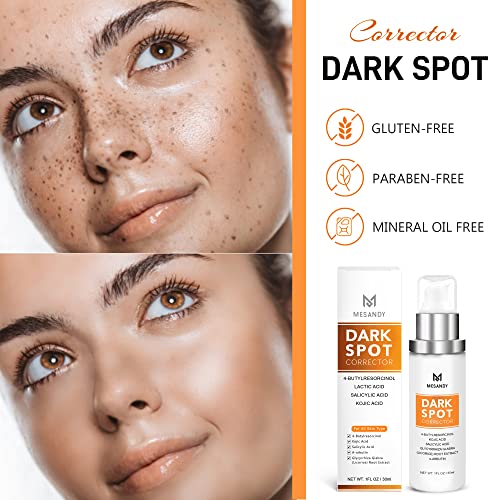 Dark Spot Corrector For Face And Body Serum, Dark Spot Remover For Women And Men, Treatment For Hyperpigmentation, Age Spot, Melasma, Brown Spots And Other Stubborn Spots #TOP6
