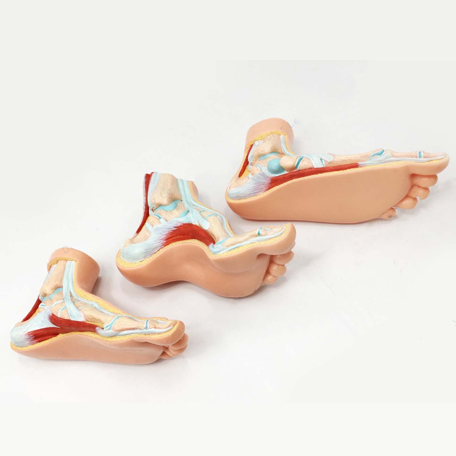 Model anatomii ludzkiej stopy Model podologiczny 3 stopy ludzkie Model z nogami pokazuje zwykłe warunki płaskostopia Szpital do nauczania stóp Normalny
