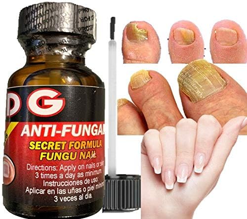 Miniatura 4 de Hongos Uñas Tratamiento para Eliminar Onicomicosis y Mantener Uñas Saludables