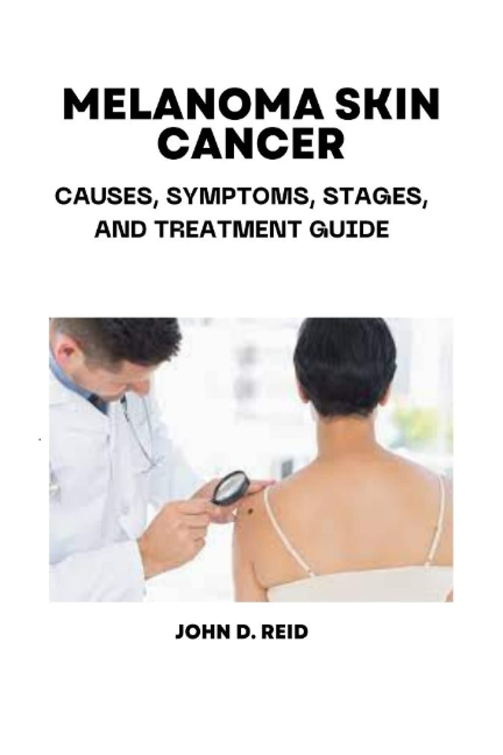 MELANOMA SKIN CANCER: CAUSES, SYMPTOMS, STAGES, AND TREATMENT GUIDE)