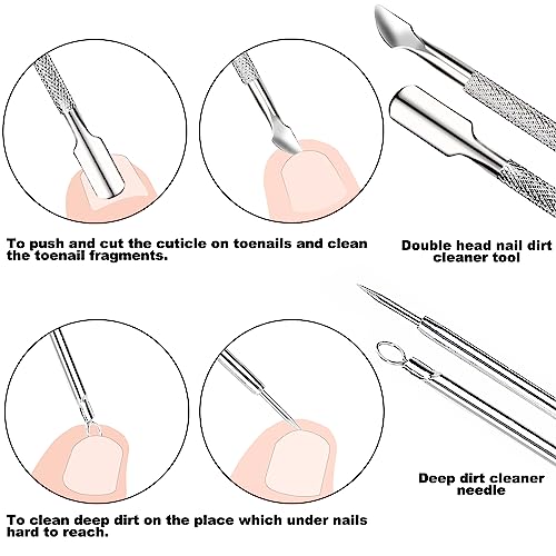 ZIZZON 7-teiliges Set mit Feilen und Hebern für eingewachsene Zehennägel, Set aus Edelstahl zum Entfernen eingewachsener Zehennägel, Nagelreiniger für die Unternagelpflege, Pediküre-Werkzeuge