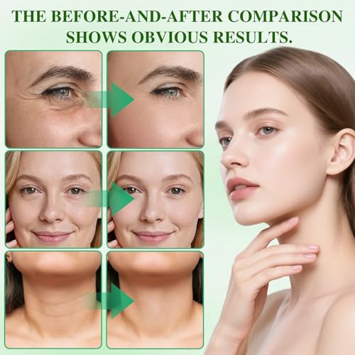 Generic 6Pcs Polypeptide Collagen, Polypeptide Collagen Elastic Essence Cream, Micro-Molecular Collagen Lotion, Firming Cream Tightening Lifting