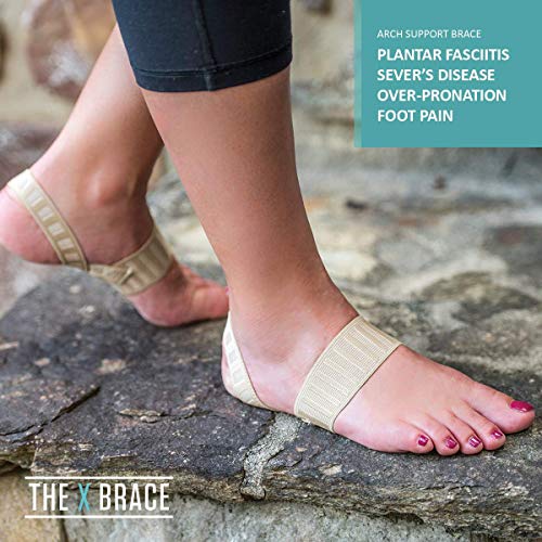 Tuli's X Brace, Arch Support Brace And Compression For Sever's Disease, Plantar Fasciitis, Heel Pain, Flat Feet, Fallen Arches And Over-Pronation, 1 Pair, Small #TOP6