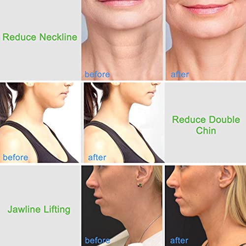 Neck Beauty Device & Facial Sculpting Tools Set of 3 - Neck Toning Exerciser + Jade Roller for Face + Gua Sha - to Improve Saggy Skin Rejuvenation & Double Chin, Define Jaw Line And Shape Vline - Thumbnail 3