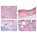 3B Scientific GmbH W13311 Human Pathology-German