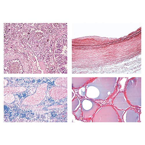 Image of 3B Scientific GmbH W13311 Human Pathology-German